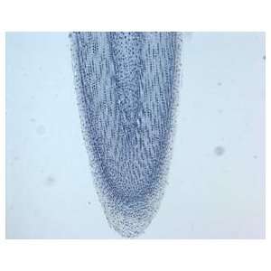   Microscopic Slides; Plant A L; Allium root tip; Longititude section