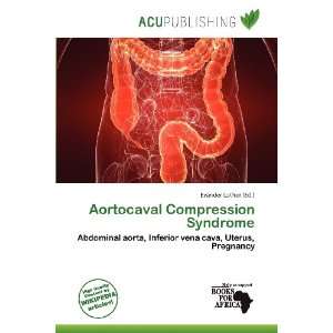  Aortocaval Compression Syndrome (9786200822086) Evander Luther Books