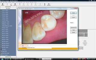 NEW IntraOral Oral DENTAL CAMERA Imaging Work/w Dexis,Dentrix 