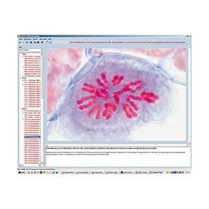   Cell Division (Mitosis and Meiosis) CD ROM Industrial & Scientific