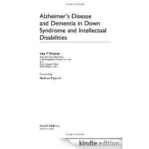 Alzheimers Disease And Dementia in Down Syndrome And Intellectual 